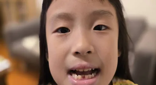 人生第一次掉牙