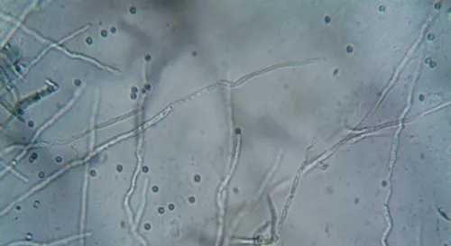 湖泊的低語：每夜細菌的秘密呼吸