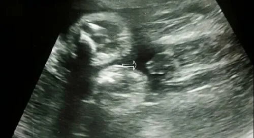 第34週了，目前正快速成長中。