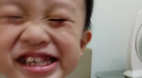 Smile till face koyak