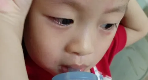 一沒注意就受傷了，眉頭紅紅的猜得到5U做了什麼好事嗎？