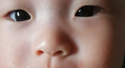 5G最近口水疹嚴重的很啊心疼死了